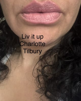 View Gallery Image #1