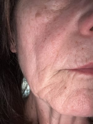 View Gallery Image #1