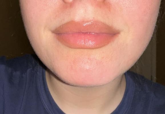 View Gallery Image #1