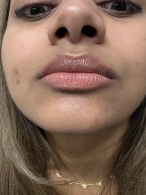 View Gallery Image #1