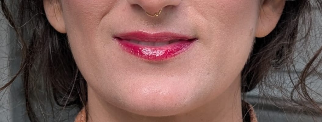 View Gallery Image #1