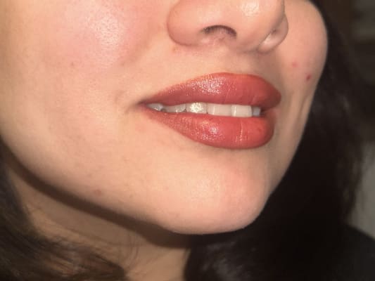 View Gallery Image #3