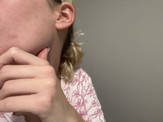 View Gallery Image #1