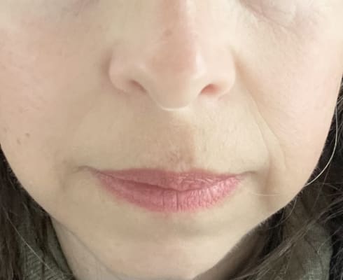 View Gallery Image #1