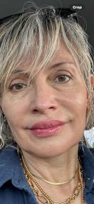 View Gallery Image #1