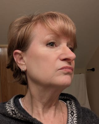 View Gallery Image #1