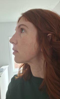 View Gallery Image #1