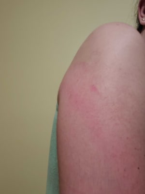 View Gallery Image #2