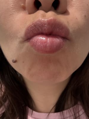 View Gallery Image #1