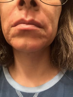 View Gallery Image #5