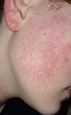 View Gallery Image #1