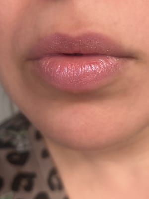 View Gallery Image #1