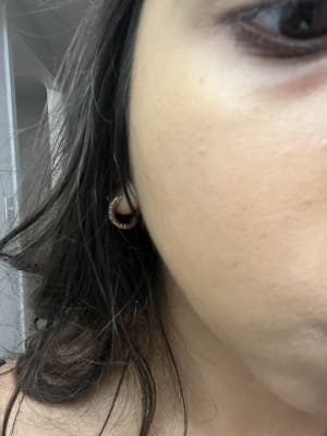 View Gallery Image #1