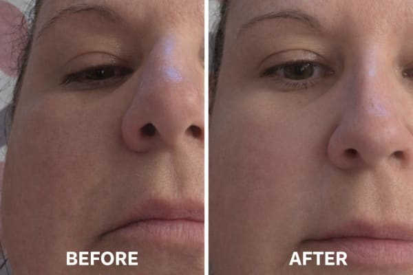 View Gallery Image #1