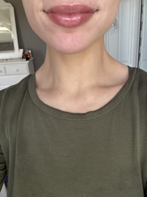 View Gallery Image #1