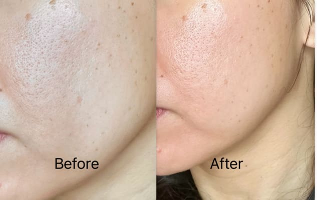 View Gallery Image #2