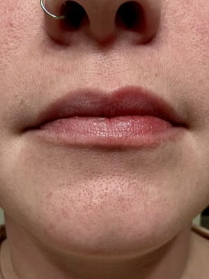 View Gallery Image #1