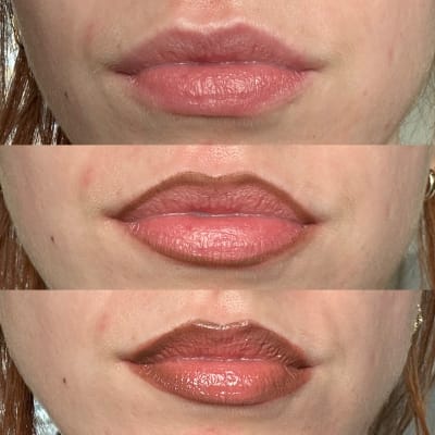 View Gallery Image #1