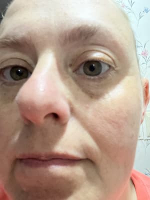 View Gallery Image #1