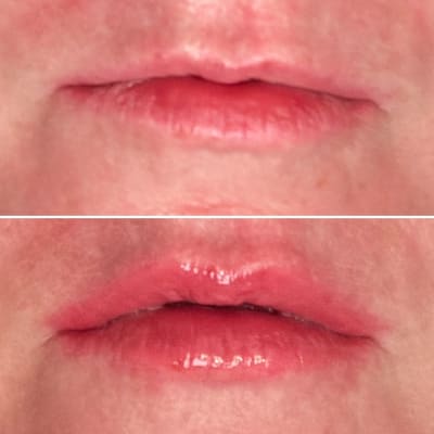 View Gallery Image #1