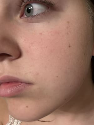 View Gallery Image #1