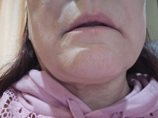 View Gallery Image #2