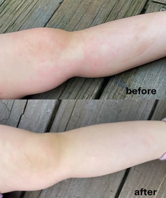 View Gallery Image #1