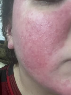 View Gallery Image #1