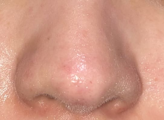 View Gallery Image #1