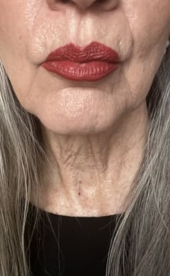 View Gallery Image #1