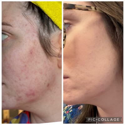 View Gallery Image #1