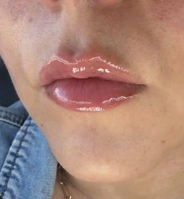 View Gallery Image #15