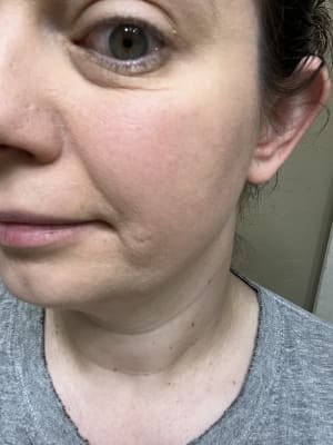 View Gallery Image #1