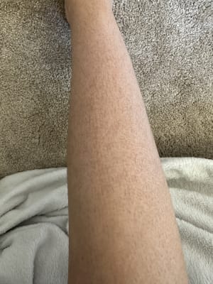 View Gallery Image #1