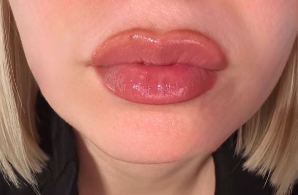 View Gallery Image #1