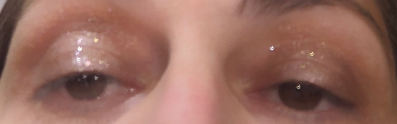 View Gallery Image #1