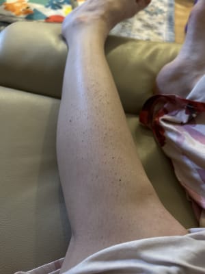 View Gallery Image #1