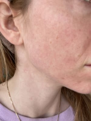 View Gallery Image #1