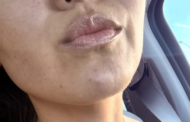 View Gallery Image #1