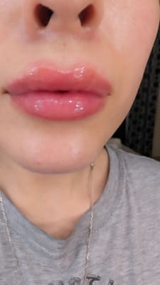 View Gallery Image #1
