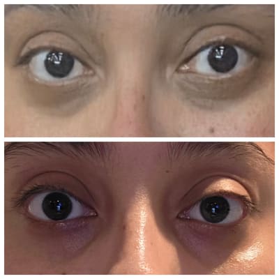 View Gallery Image #1