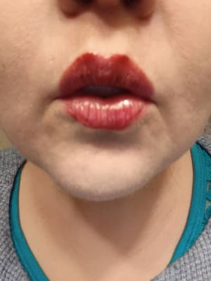 View Gallery Image #1