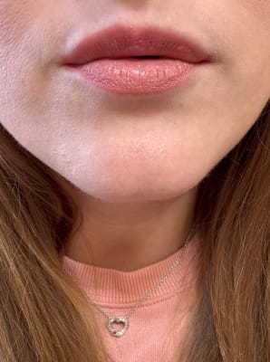 View Gallery Image #2