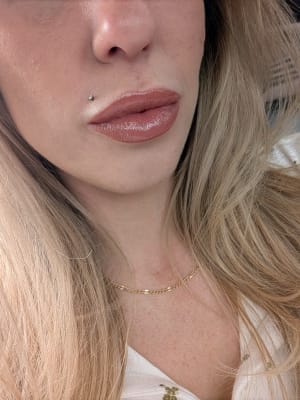 View Gallery Image #1