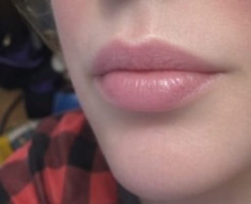 View Gallery Image #1