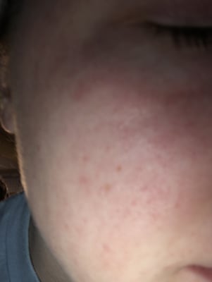 View Gallery Image #1