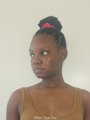 View Gallery Image #1