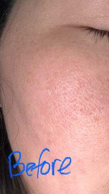 View Gallery Image #1