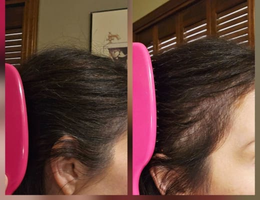 View Gallery Image #10