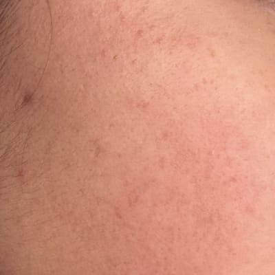 View Gallery Image #15